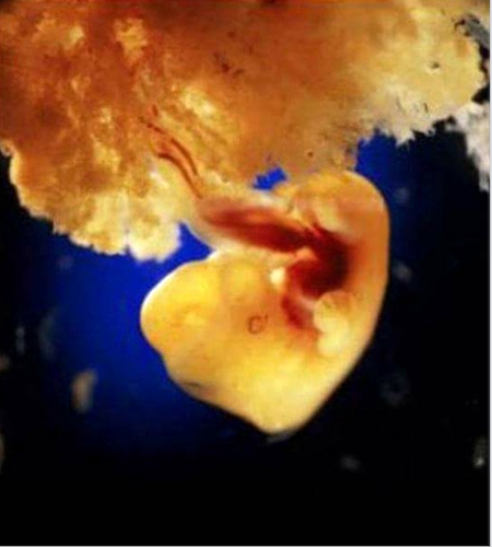 Slika br. 11 - Nakon četrdeset dana formira se placenta 
