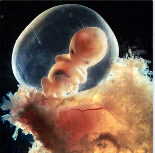 Slika br. 12 - Nakon osam sedmica, embrio je veoma dobro zaštićen u fetalnoj kesi